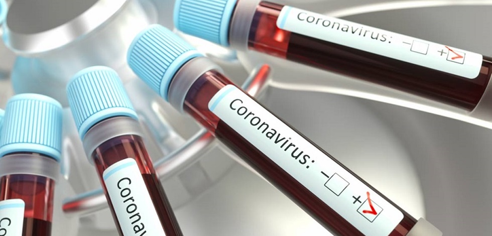 Bu ilaç, Koronavirüse bağlı ölümleri azaltabiliyor mu?